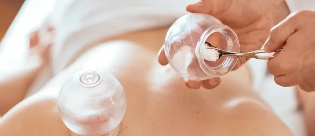 Cupping Therapy Bangkok: Dry vs Wet, Marks and current Ritual